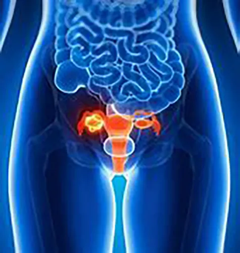 A blue image of the human body with an orange spot in it.
