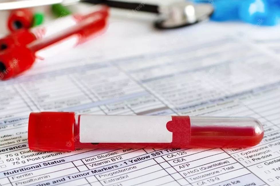 A red pen on top of some papers
