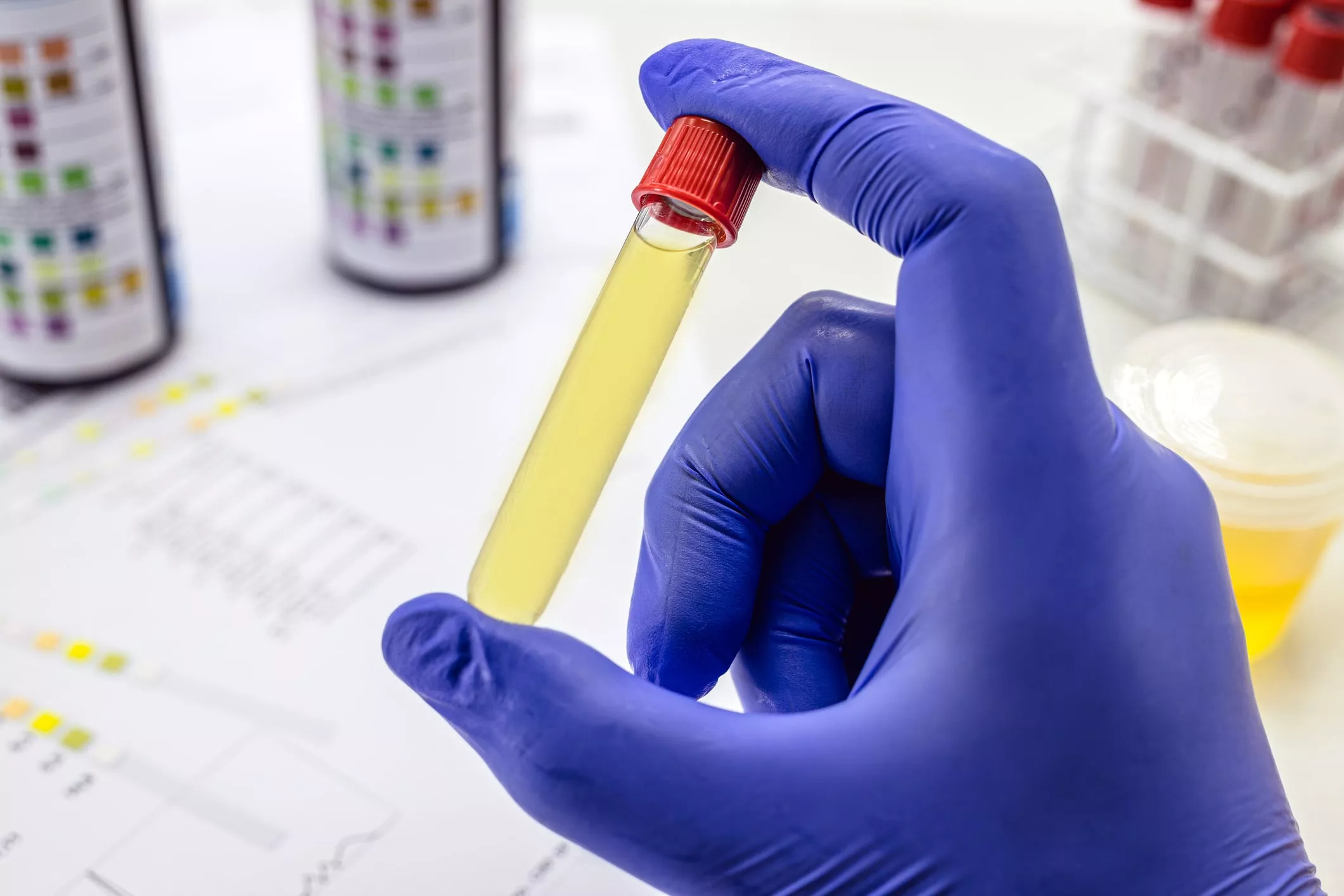 A person holding a test tube in their hand.