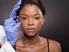 A woman getting her face measured for surgery.