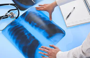 A person is holding their hands over an x-ray.