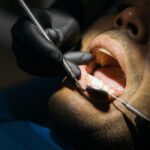 A man is getting his teeth cleaned by an dentist.