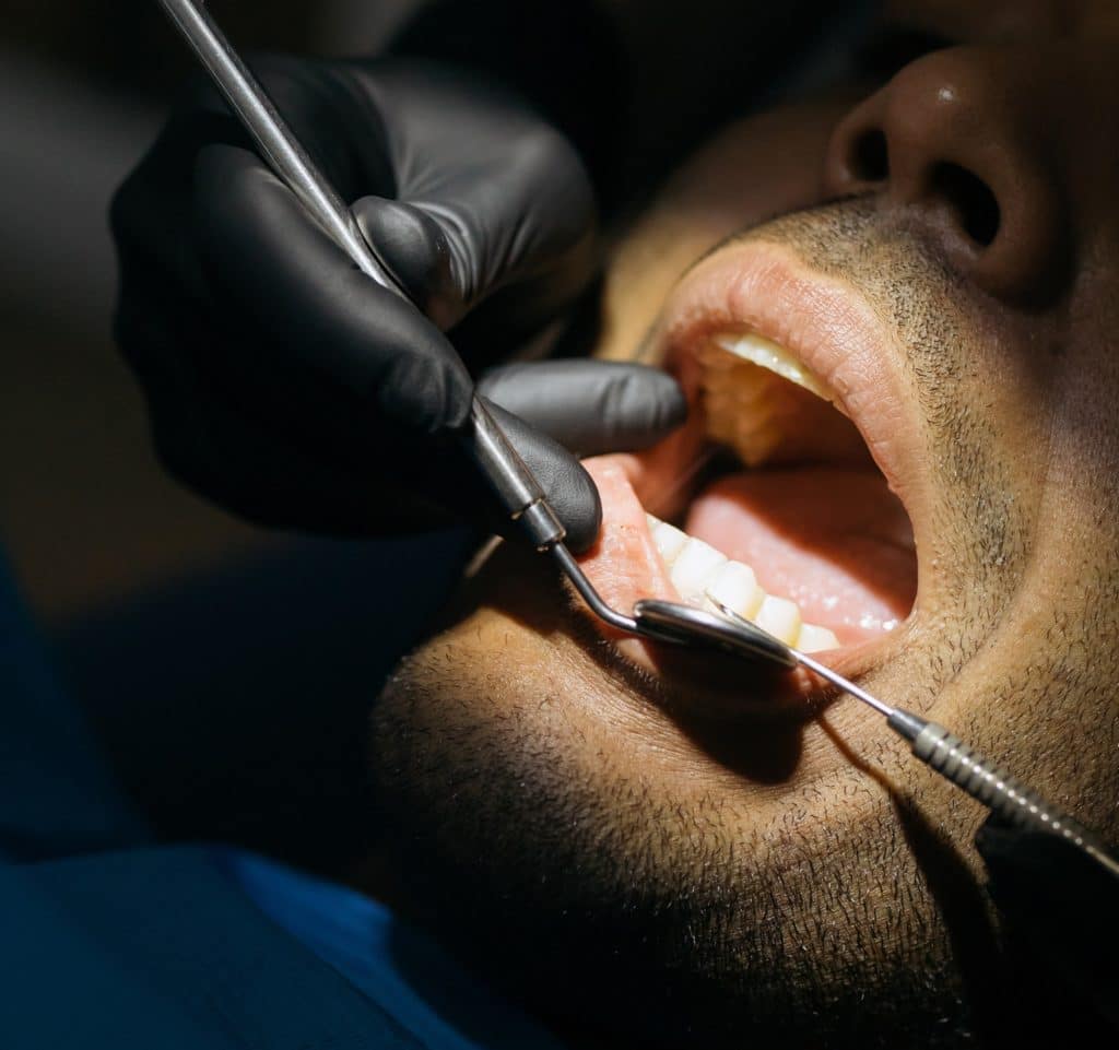 A man is getting his teeth cleaned by an dentist.